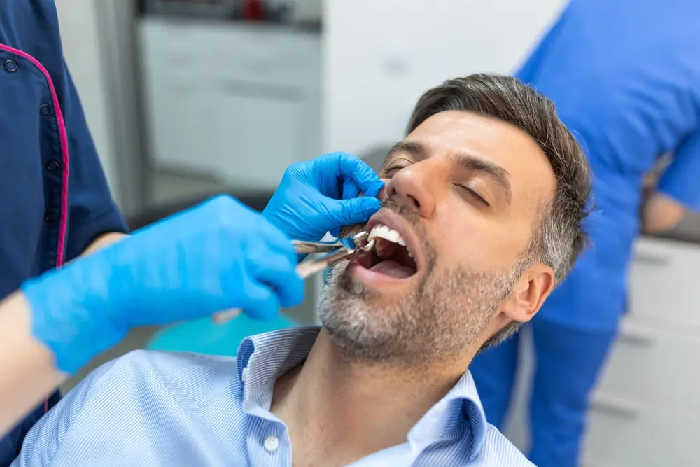 tooth extractions salisbury